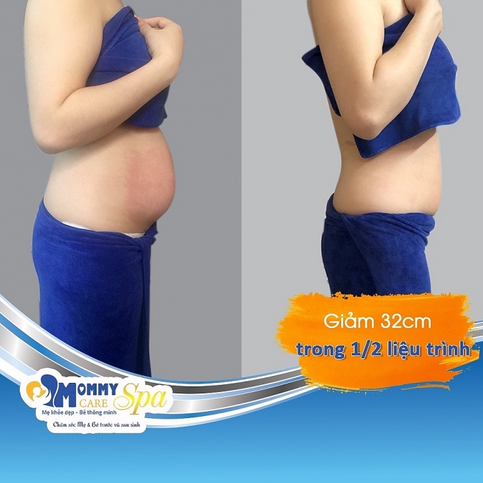 Mommy Care Spa: Sự lựa chọn hoàn hảo nâng niu sức khỏe mẹ và bé mommy care spa su lua chon hoan hao nang niu suc khoe me va be