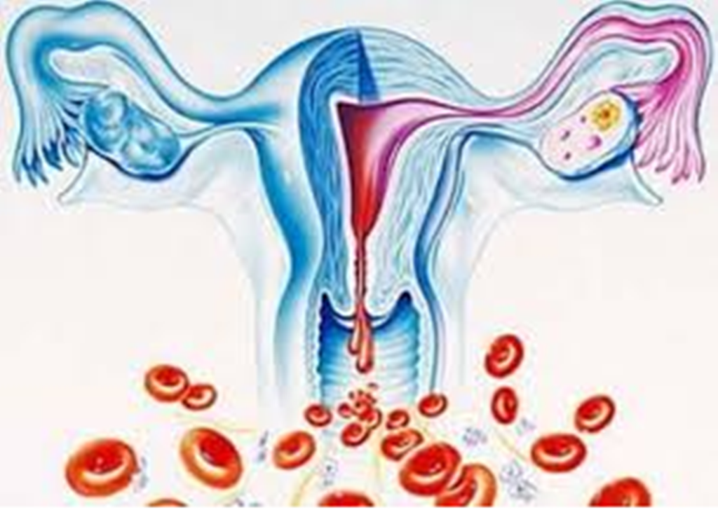 Bệnh u xơ tử cung, u nang buồng trứng và những điều bạn chưa biết benh u xo tu cung u nang buong trung va nhung dieu ban chua biet