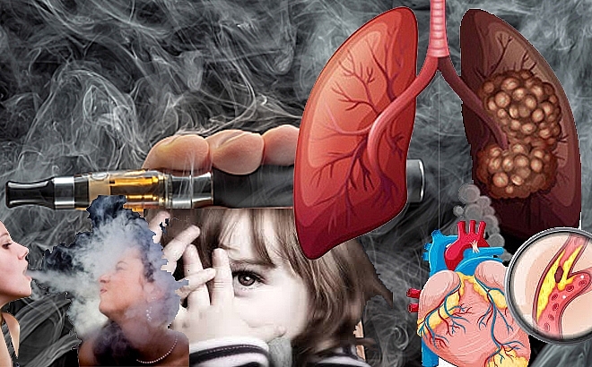 Tăng số ca nhập viện do tổn thương phổi cấp vì thuốc lá điện tử