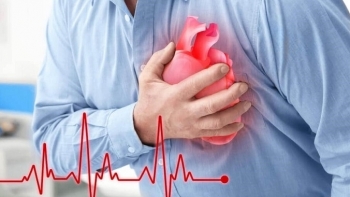 Bác sỹ tim mạch và nỗi ám ảnh về ca bệnh tai biến hậu Covid-19