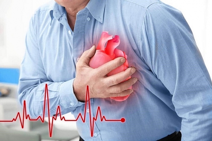 Bác sỹ tim mạch và nỗi ám ảnh về ca bệnh tai biến sau Covid-19