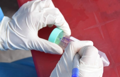 Đầu bếp kiêm shipper của quán pizza trên phố Đoàn Trần Nghiệp dương tính với Covid-19