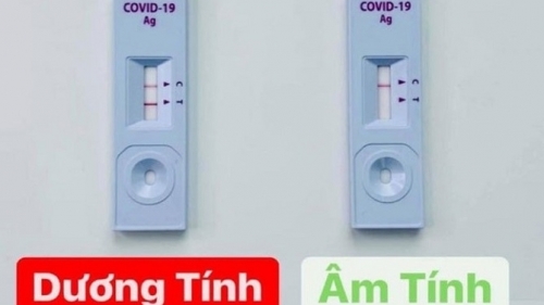 Hà Nội: Khi test nhanh dương tính người dân cần liên hệ ngay với y tế địa phương